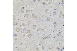 Immunohistochemistry of paraffin-embedded mouse brain using EIF3F Antibody (ABIN2562388) at dilution of 1:100 (40x lens). (EIF3F antibody)