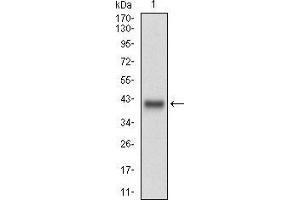 Western blot analysis using MLANA mAb against human MLANA (AA: 48-118) recombinant protein.