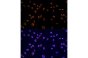 Immunofluorescence analysis of C6 using SMC3 antibody (ABIN7270616) at dilution of 1:100. (SMC3 antibody)