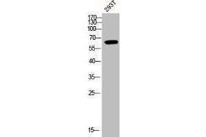 Western Blot analysis of 293T cells using Phospho-Akt1 (Y474) Polyclonal Antibody (AKT1 antibody  (pTyr474))