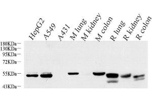 Western Blot analysis of various samples using CK-7 Monoclonal Antibody at dilution of 1:1000. (Cytokeratin 7 antibody)