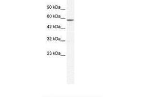 Image no. 2 for anti-General Transcription Factor IIE, Polypeptide 1, alpha 56kDa (GTF2E1) (C-Term) antibody (ABIN6736041)