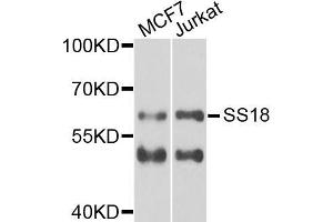 Western blot analysis of extracts of various cell lines, using SS18 antibody (ABIN5975075) at 1/1000 dilution. (SS18 antibody)