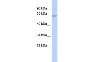 WB Suggested Anti-GALNTL4 Antibody Titration:  0. (UDP-N-Acetyl-alpha-D-Galactosamine:polypeptide N-Acetylgalactosaminyltransferase 18 (GALNT18) (Middle Region) antibody)