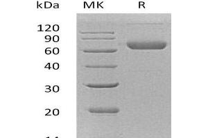 Western Blotting (WB) image for Ephrin B2 (EFNB2) protein (His tag,Fc Tag) (ABIN7320517) (Ephrin B2 Protein (EFNB2) (His tag,Fc Tag))