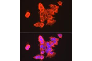 Immunofluorescence analysis of MCF7 cells using CLDN3 antibody (ABIN3017039, ABIN3017040, ABIN3017041, ABIN1679261 and ABIN6219930) at dilution of 1:100. (Claudin 3 antibody)