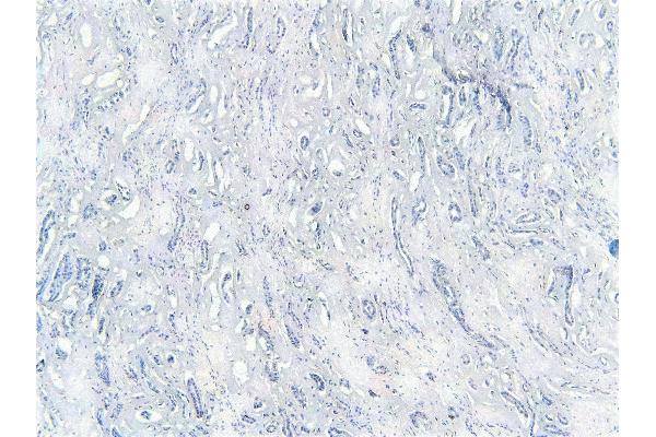 TRIM8 antibody  (C-Term)