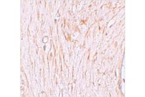 Immunohistochemistry of ZBTB7A in Human ovary tissue with ZBTB7A / Pokemon antibody at 2. (ZBTB7A antibody  (N-Term))
