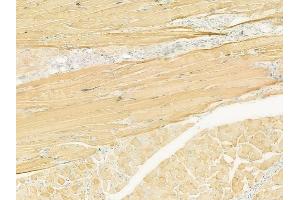 ABIN6260856 and ABIN6273101 at 1/100 staining human tongue carcinoma by IHC-P. (CKMT1A antibody  (N-Term))