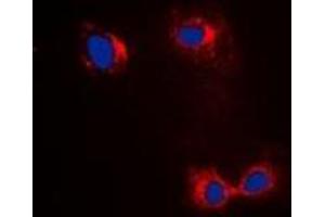 Immunofluorescent analysis of Beta-actin staining in Hela cells. (beta Actin antibody)