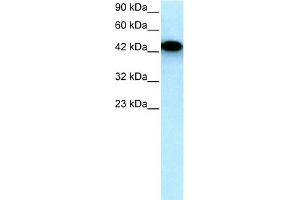 WB Suggested Anti-EYA3 Antibody Titration:  0. (EYA3 antibody  (Middle Region))