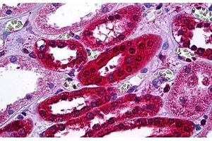 Human Kidney, Tubules: Formalin-Fixed, Paraffin-Embedded (FFPE) (AKR1B1 antibody  (AA 1-316))