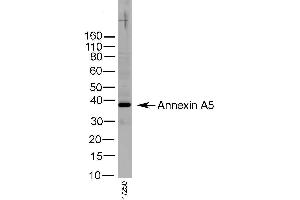 Western Blotting (WB) image for anti-Annexin A5 (ANXA5) antibody (ABIN2477449) (Annexin V antibody)
