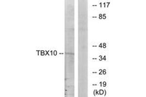 Western blot analysis of extracts from HT-29 cells, using TBX10 Antibody. (T-Box 10 antibody  (AA 261-310))