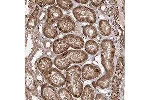 Immunohistochemical staining of human kidney with ETAA1 polyclonal antibody  shows distinct nuclear and cytoplasmic positivity in tubular cells. (ETAA1 antibody)
