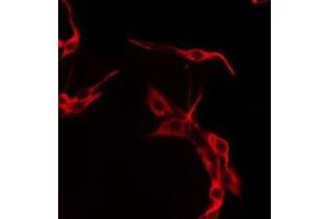 ABIN6275666 staining HepG2 by IF/ICC. (UEVLD antibody  (N-Term))