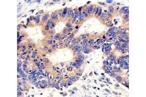 Immunohistochemistry (IHC) image for anti-Proprotein Convertase Subtilisin/kexin Type 9 (PCSK9) (AA 479-508) antibody (ABIN3032342)