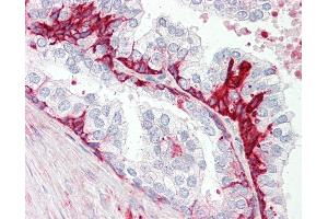 Anti-GPR55 antibody IHC staining of human prostate.