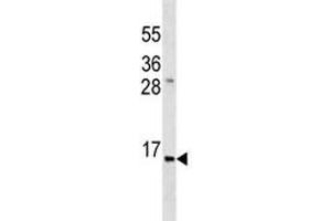 Anti-Insulin antibody western blot analysis in ZR-75-1 lysate. (Insulin antibody  (AA 35-64))