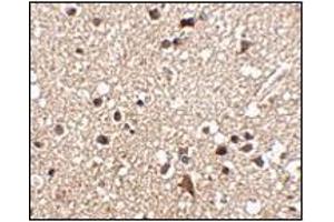 Immunohistochemistry of JPH3 in human brain tissue with this product at 2. (Junctophilin 3 antibody  (C-Term))