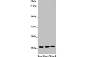 Western blot All lanes: MOCS2 antibody at 1. (MOCS2 antibody  (Catalytic Subunit))