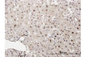 Immunoperoxidase of monoclonal antibody to PRKDC on formalin-fixed paraffin-embedded human liver. (PRKDC antibody  (AA 4019-4128))