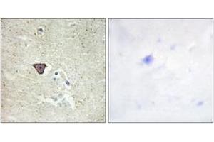 Immunohistochemistry analysis of paraffin-embedded human brain tissue, using CDH9 Antibody. (Cadherin 9 antibody  (AA 201-250))