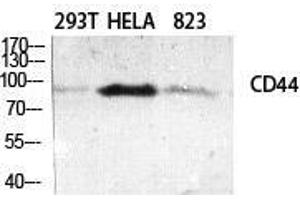 Western Blot (WB) analysis of specific cells using CD44 Polyclonal Antibody. (CD44 antibody  (Ser2152))