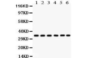 Western Blotting (WB) image for anti-Cyclin-Dependent Kinase 1 (CDK1) (AA 66-297) antibody (ABIN3043473) (CDK1 antibody  (AA 66-297))