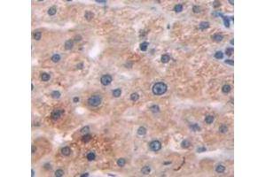 IHC-P analysis of Human Tissue, with DAB staining. (Complement Factor I antibody  (AA 340-583))