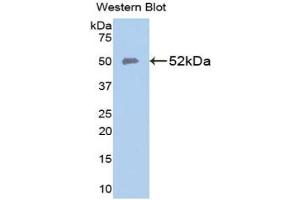 SLC40A1 anticorps  (AA 127-321)
