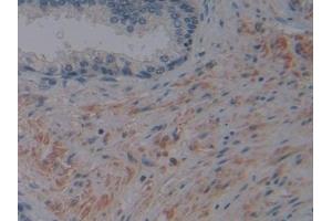 Detection of FAPa in Human Prostate Tissue using Polyclonal Antibody to Fibroblast Activation Protein Alpha (FAPa) (FAP antibody  (AA 523-760))