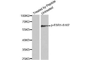 Western blot analysis of extracts from MCF7 cells using Phospho-ESR1-S167 antibody (ABIN2988007). (Estrogen Receptor alpha antibody  (pSer167))