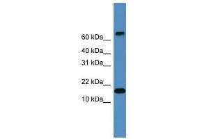 Western Blot showing CST9 antibody used at a concentration of 1-2 ug/ml to detect its target protein.