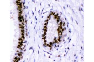 IHC analysis of p95 NBS1 using anti-p95 NBS1 antibody (ABIN3043282).
