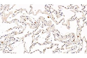 Detection of PD1 in Human Lung Tissue using Polyclonal Antibody to Programmed Cell Death Protein 1 (PD1) (PD-1 antibody  (AA 41-132))