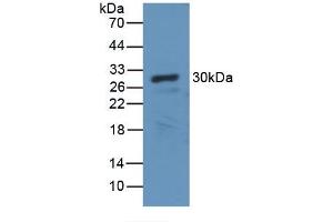 Detection of Recombinant CA2, Canine using Polyclonal Antibody to Carbonic Anhydrase II (CA2) (CA2 antibody)