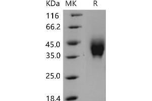 Western Blotting (WB) image for Interferon gamma Receptor 2 (Interferon gamma Transducer 1) (IFNGR2) protein (His tag) (ABIN7320197) (IFNGR2 Protein (His tag))