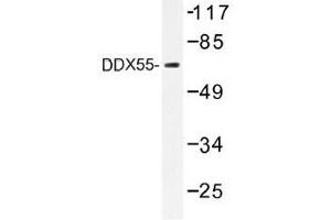 Image no. 1 for anti-DEAD (Asp-Glu-Ala-Asp) Box Polypeptide 55 (DDX55) antibody (ABIN317819) (DDX55 antibody)