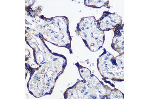 Immunohistochemistry of paraffin-embedded Human placenta using P Rabbit pAb (ABIN6133216, ABIN6145242, ABIN6145243 and ABIN6216694) at dilution of 1:100 (40x lens). (PARP8 antibody  (AA 1-300))