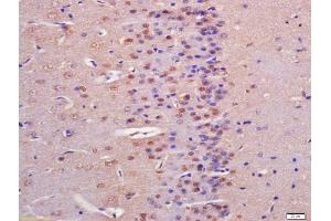 Formalin-fixed and paraffin embedded rat brain labeled with Anti-IGFBP9 Polyclonal Antibody, Unconjugated (ABIN761816) at 1:200 followed by conjugation to the secondary antibody and DAB staining (NOV antibody  (AA 221-320))