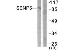 Western blot analysis of extracts from COS7 cells, using SENP5 Antibody.