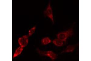 ABIN6274802 staining Hela cells by IF/ICC.