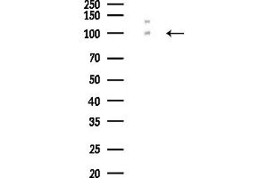 anti-EPH Receptor A3 (EPHA3) (C-Term) antibody