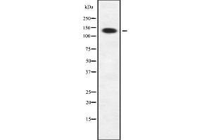 Western blot analysis Sin3B using A549 whole cell lysates (SIN3B antibody  (Internal Region))