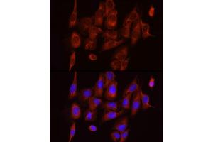 Immunofluorescence analysis of U2OS cells using S6 Ribosomal Protein (RPS6) Rabbit mAb (ABIN7270026) at dilution of 1:100 (40x lens). (RPS6 antibody)