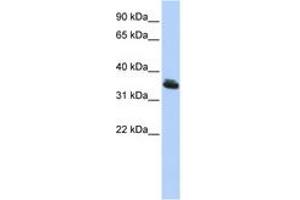 Image no. 1 for anti-LIM Homeobox 3 (LHX3) (C-Term) antibody (ABIN6742273) (LHX3 antibody  (C-Term))