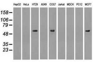 Image no. 2 for anti-Nuclear Receptor Binding Protein 1 (NRBP1) antibody (ABIN1499828) (NRBP1 antibody)