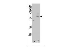 Western blot analysis of AT(Slc29a4) (arrow) using rabbit polyclonal AT(Slc29a4) Antibody (C-term) (ABIN387944 and ABIN2844505). (SLC29A4 antibody  (AA 452-481))