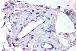 Human Testis, Vessels (formalin-fixed, paraffin-embedded) stained with ADAMTS1 antibody ABIN290128 at 13 ug/ml followed by biotinylated goat anti-rabbit IgG secondary antibody ABIN481713, alkaline phosphatase-streptavidin and chromogen. (ADAMTS1 antibody  (Internal Region))